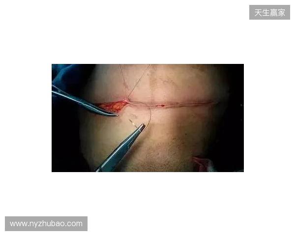 广州豹官方：杨浩眉弓伤口缝合30余针，预计5-7天后拆线